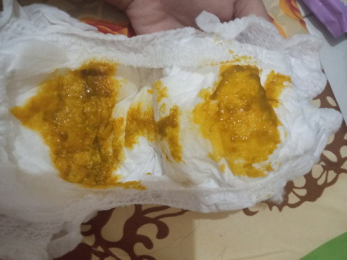 Normal atau tidak ya bun?