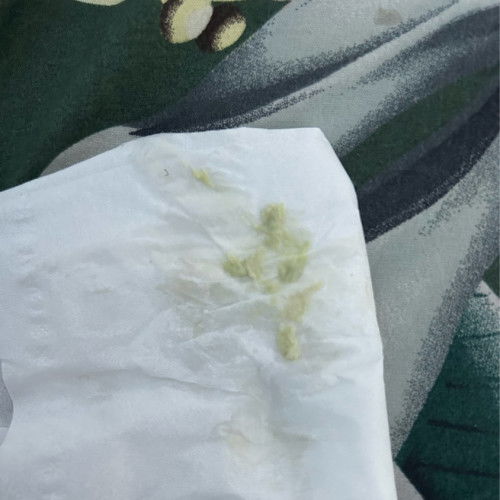 Selama Hamil sering Keputihan