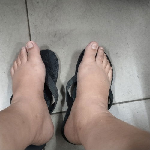 Kaki mulai bengkak hamil 20w3d