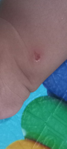 Bentol isi air