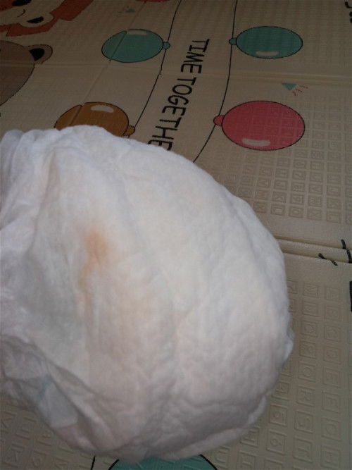 anak 5bln nambah tinggi tapi bb seret di pampers ada bercak pink sedikit