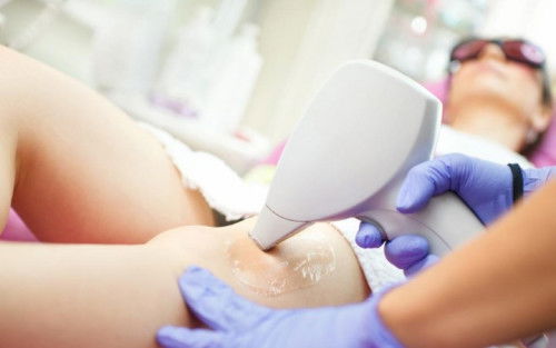 Laser Hair Removal in Delhi - Dr. Rohit Batra