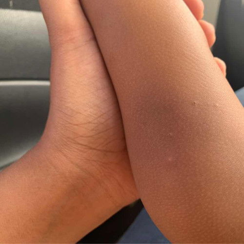 Biji merah ada mata hitam