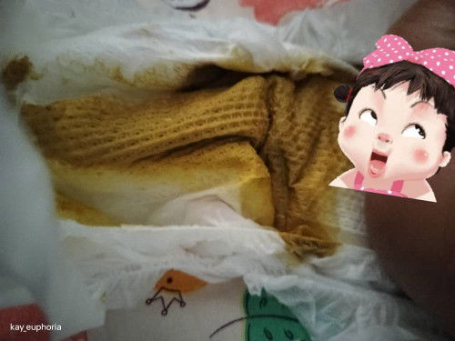 Najis bayi normal atau tidakk ?