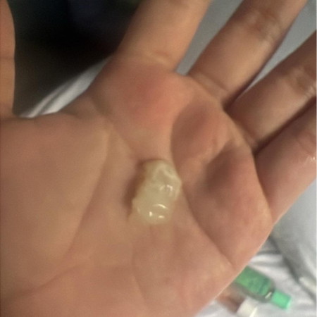 Mucus plug na po ba ito?