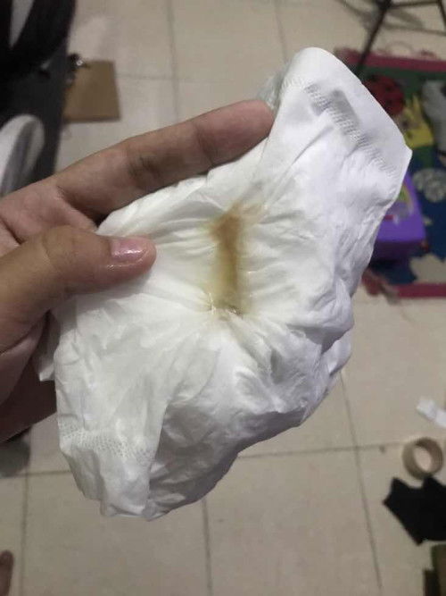 keluar lendir coklat