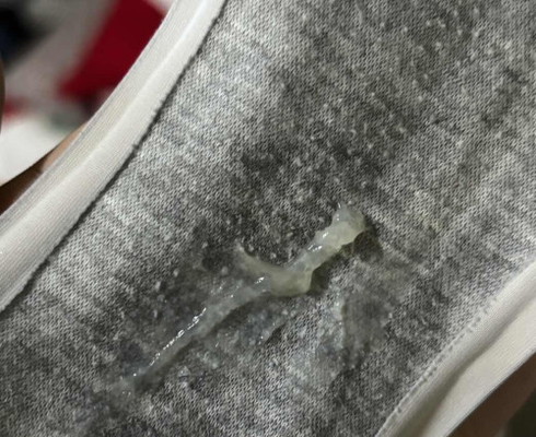 Mucus Plug?