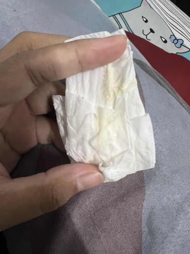 Saya kerap keluar mcmni . Sejak masuk 36+ skang saya dh 37weeks 4 day still ad lagi .. ni apa eh ?..