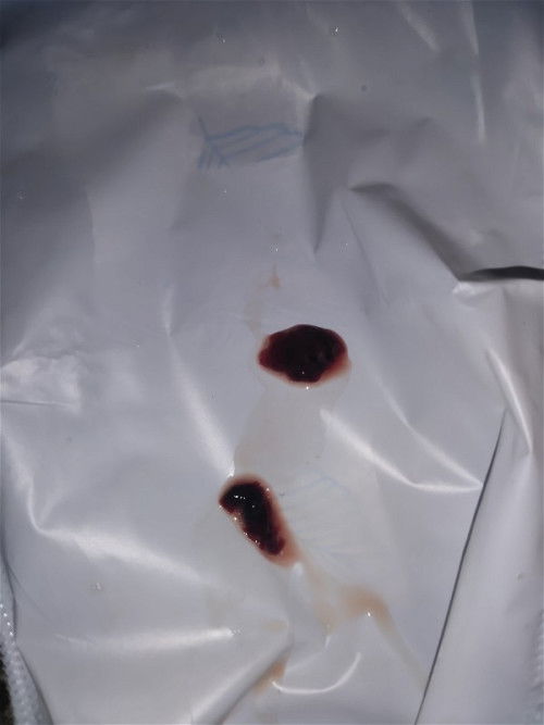 Keluar seperti ini di usia 37 week