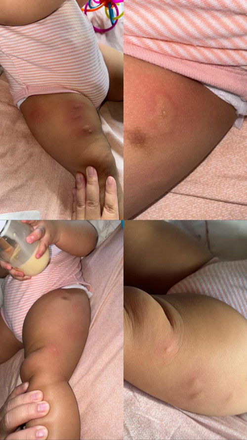 Salam Mommy, ni kena gigit apa ye? risau pulak saya. First time mommy ni hm ada tips pape tak ?