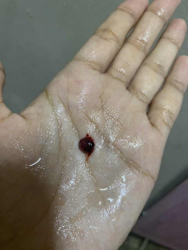 ni keguguran ke ?