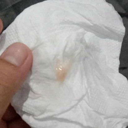 สอบถามแม่ๆคะ