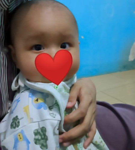 Mata Anak Apakah Normal Seperti Ini?