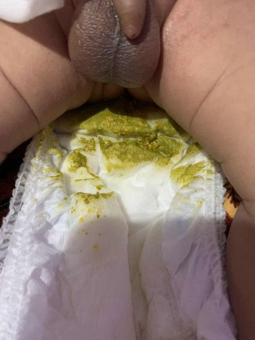 pup bayi 20 hari berwarna hijau