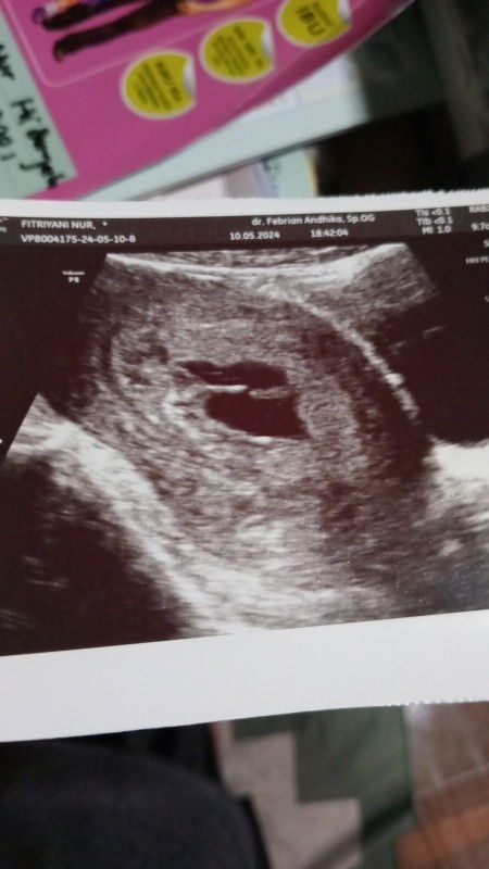 hpht usia 10w tp pas di usg baru 6w