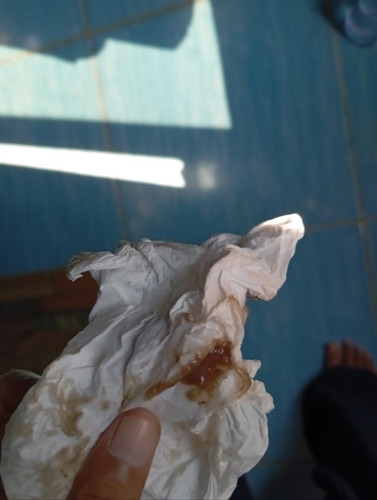 Maaf bun klo jorok π
Saya hamil usia 7week tp kok keluar flek seperti itu aman apa tdak ya bun π