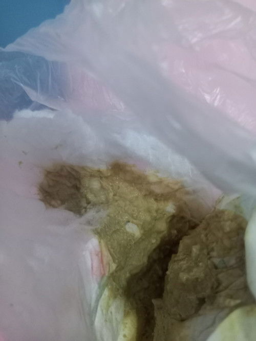 Apakah pup anak mau 1thn krng 1minggu kaya gini normal ya soalnya pucet wrnanya bau nya nyengat