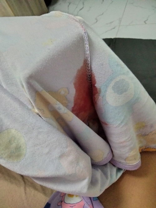 กำลังเตรียมตัวฝากครรภ์