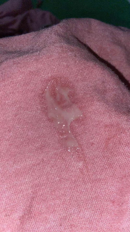 HPL 10 MEI SUDAH LEWAT, BARU KELUAR LENDIRNYA SAJA TIDAK ADA FLEK COKLAT ATAU DARAH