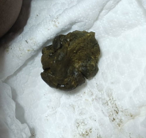 Is this normal Baby Poop ?