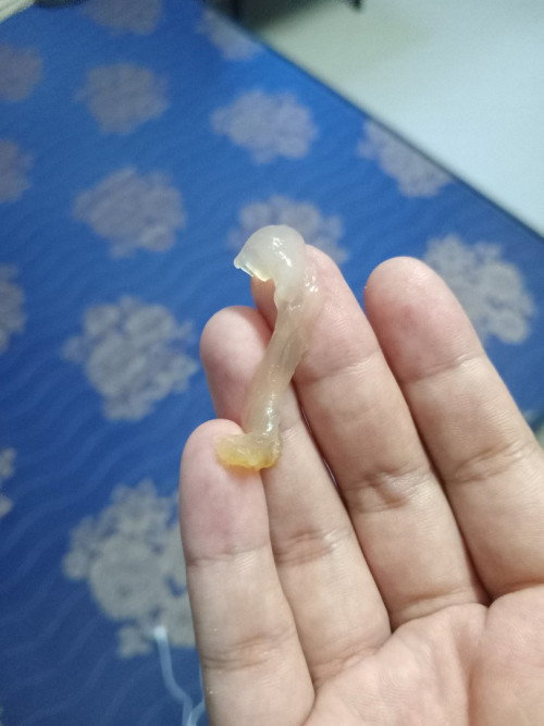 39+1 มีมูกใส