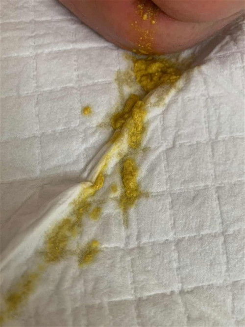 อึน้องอายุ 4 วัน  ปกติไหมคะ