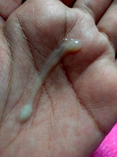Mucus plug atau keputihan