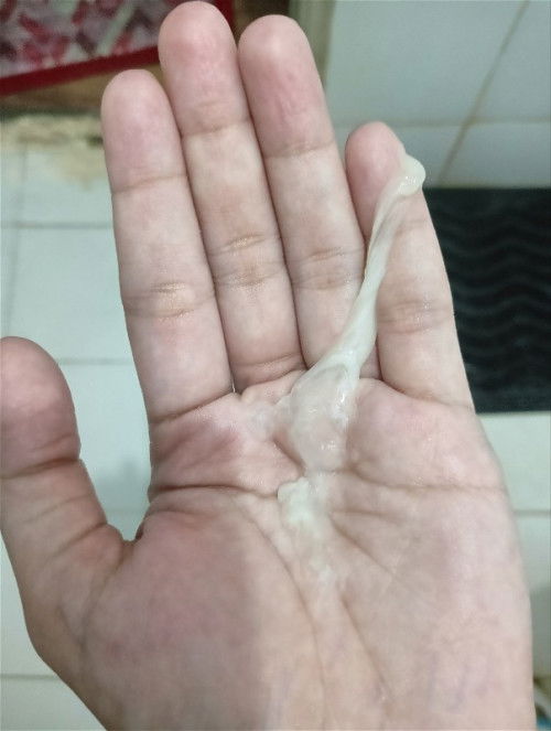 MALAPIT NA PO BA MANGANAK KAPAG MAY LUMABAS NA PARANG SIPON?