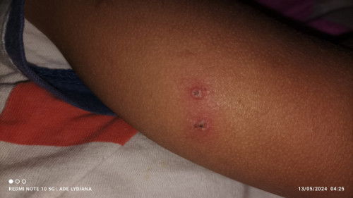 Ada yang punya pengalaman sama?