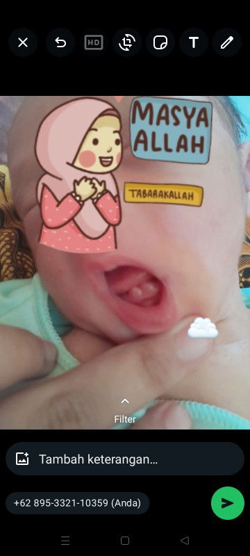 mau tanya Bun,  anak saya baru lahir ko kaya muncul gusi 2 Bun ada yang tau kenapa ya Bun...