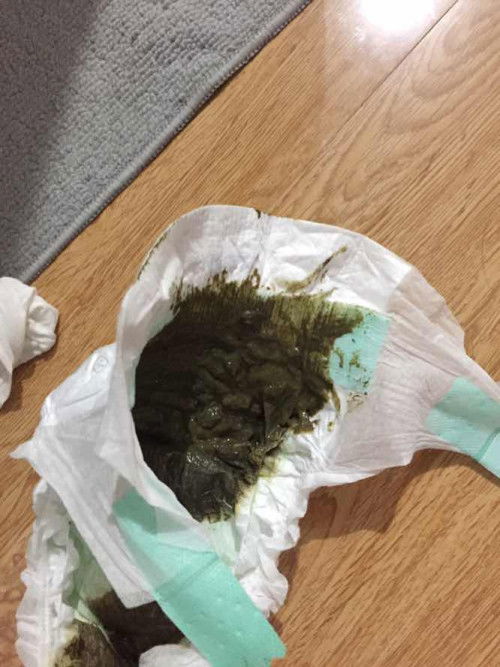 Poops sa bagoong nag formula ng milk