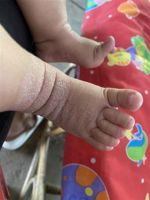 สอบถามเเม่ๆหน่อยค่ะ