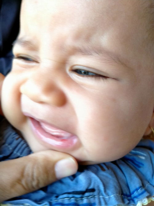 Obat bibir pada bayi