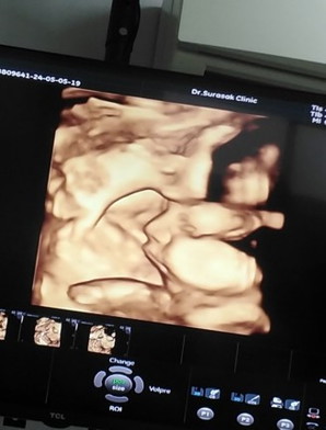 กำหนดคลอด20กรกฎาคม👶💝