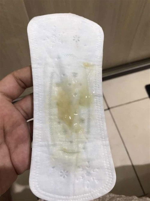 Keputihan dikehamilan tua