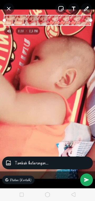 Kepala tidak simetris pada anak