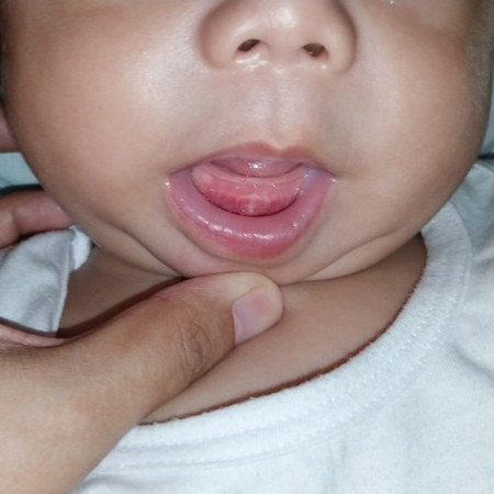 Teething at 5mos old