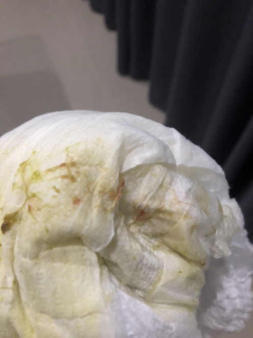 สอบถามแม่ๆหน่อยคะ