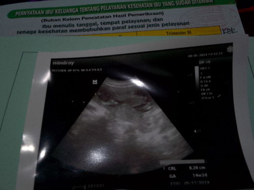 Ingin bertanya pada bunda-bunda sekalian