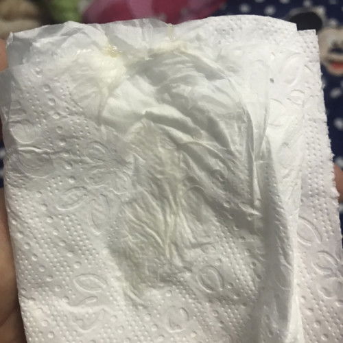 มูกออกมาแบบนี้ กี่วันถึงคลอดคะ