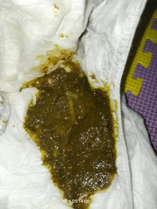 Bab bayi setelah MPASI umur 6 bulan 2 Minggu menurut kalian ini normal atau tidak?