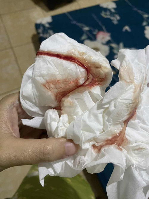 Lendir darah di 39w5 day