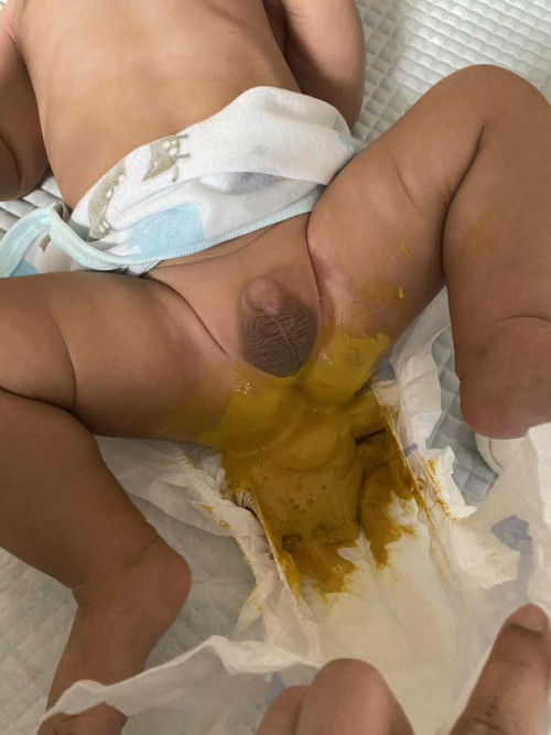 pup cair, kental dan tidak bertekstur