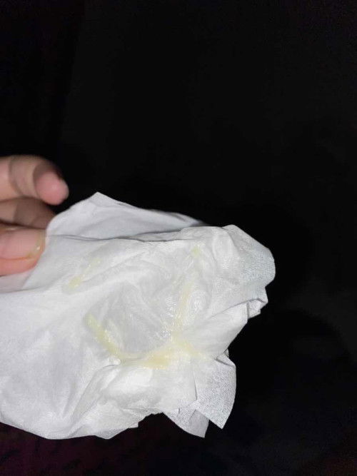 KEPUTIHAN ABNORMAL😢