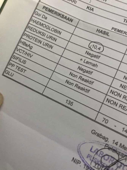 Cek lab urine