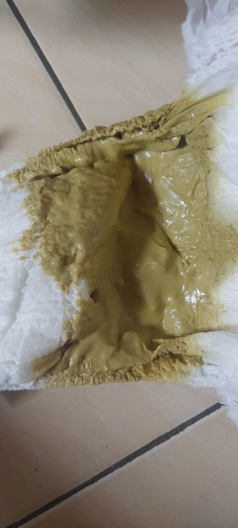 Baru ganti sufor pup seperti ini