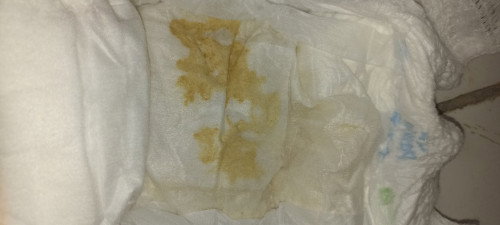 Disini ada gk yang pipis s kecil  kaya ada bercak coklat muda gini,,
