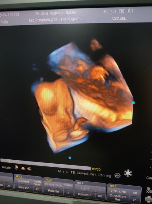 29 week ternyata masuk panggul banget dah dibawah banget