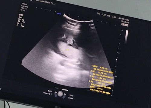 #ทีมกันยา67 #ลูกชาย