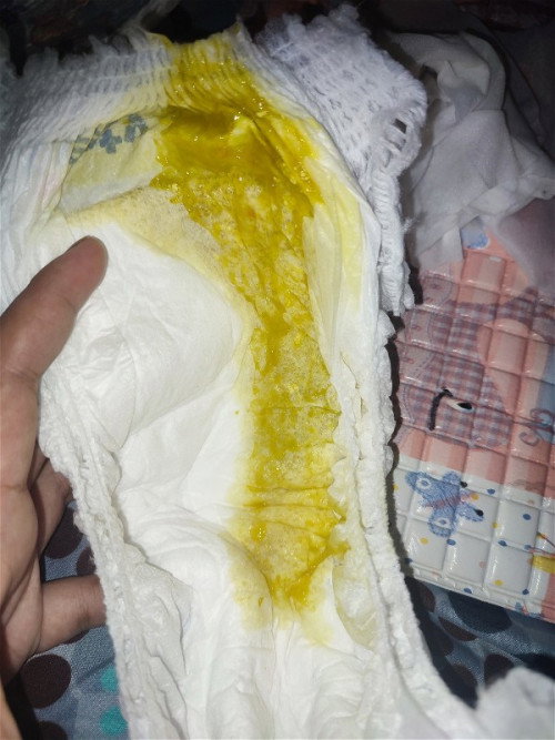 Pup bayi cair dan berlendir